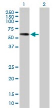 Anti-PNLIPRP2 antibody produced in mouse purified immunoglobulin, buffered aqueous solution