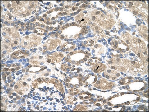 Anti-PSEN2 antibody produced in rabbit affinity isolated antibody