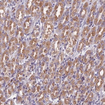 Anti-DDX51 antibody produced in rabbit Prestige Antibodies&#174; Powered by Atlas Antibodies, affinity isolated antibody, buffered aqueous glycerol solution