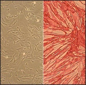 Human Internal Thoracic Artery Smooth Muscle Cells: HITASMC, adult