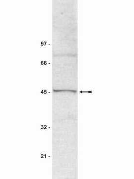 抗-SUV39H1抗体，克隆MG44 ascites fluid, clone MG44, Upstate&#174;