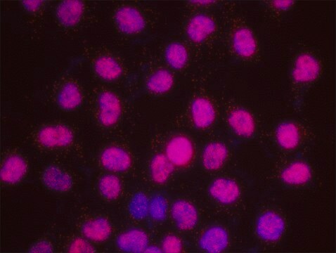 ATM and SMC3 PLA&#174; Antibody Kit Powered by Bethyl Laboratories, Inc.