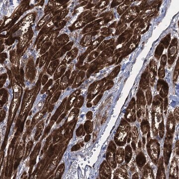 Anti-TXNDC11 antibody produced in rabbit Prestige Antibodies&#174; Powered by Atlas Antibodies, affinity isolated antibody, buffered aqueous glycerol solution