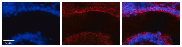 Anti-MICALL1 antibody produced in rabbit affinity isolated antibody