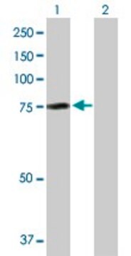 Anti-AHI1 antibody produced in rabbit purified immunoglobulin, buffered aqueous solution