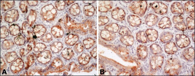 Anti-FUS (internal) antibody produced in rabbit ~1.0&#160;mg/mL, affinity isolated antibody