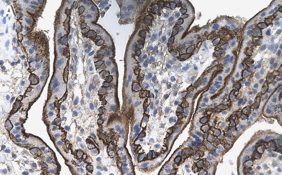 Anti-CD46 Antibody, clone 1C10 ZooMAb Rabbit Monoclonal Sigma-Aldrich