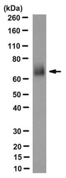 Anti- LTP/CETP Antibody, clone 3-11D clone 3-11D, from mouse