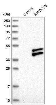 Anti-RWDD2B antibody produced in rabbit Prestige Antibodies&#174; Powered by Atlas Antibodies, affinity isolated antibody, buffered aqueous glycerol solution