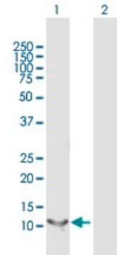 Anti-RBP5 antibody produced in mouse purified immunoglobulin, buffered aqueous solution