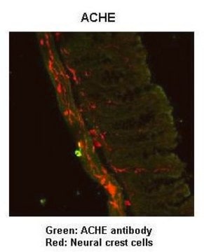 Anti-ACHE, (N-terminal) antibody produced in rabbit affinity isolated antibody