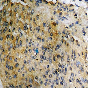 抗-磷酸化-Tau (pSer356) 兔抗 affinity isolated antibody