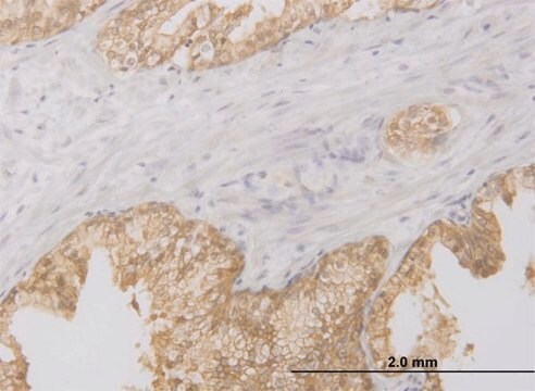 ANTI-RIPK2 antibody produced in mouse clone 3D9, purified immunoglobulin, buffered aqueous solution