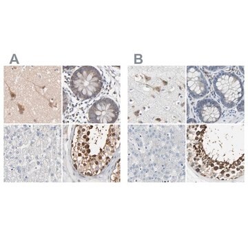 Anti-CCT5 antibody produced in rabbit Prestige Antibodies&#174; Powered by Atlas Antibodies, affinity isolated antibody, buffered aqueous glycerol solution