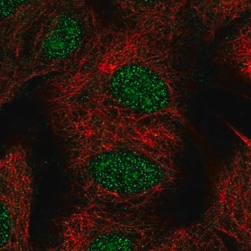 Anti-TYW1B antibody produced in rabbit Prestige Antibodies&#174; Powered by Atlas Antibodies, affinity isolated antibody