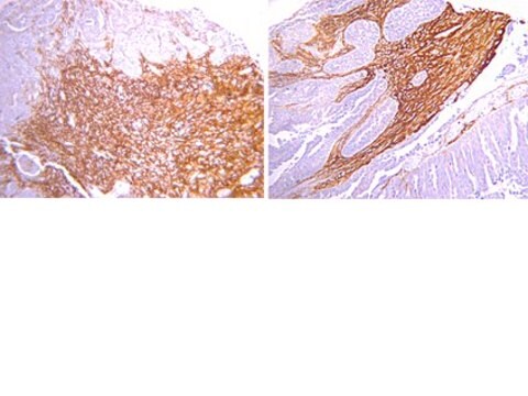 Anti-Osteopontin Antibody serum, from rabbit