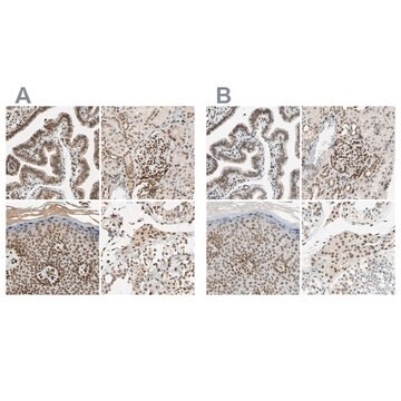 ANTI-SUN1 antibody produced in rabbit Ab2, Prestige Antibodies&#174; Powered by Atlas Antibodies, affinity isolated antibody, buffered aqueous glycerol solution