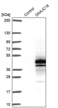 Anti-DNAJC18 antibody produced in rabbit Prestige Antibodies&#174; Powered by Atlas Antibodies, affinity isolated antibody, buffered aqueous glycerol solution