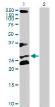 Anti-RCHY1 antibody produced in rabbit purified immunoglobulin, buffered aqueous solution