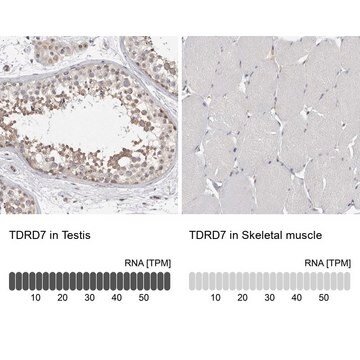 Anti-TDRD7 antibody produced in rabbit Prestige Antibodies&#174; Powered by Atlas Antibodies, affinity isolated antibody, buffered aqueous glycerol solution