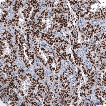 Monoclonal Anti-OTP antibody produced in mouse Prestige Antibodies&#174; Powered by Atlas Antibodies, clone CL11225, purified immunoglobulin, buffered aqueous glycerol solution