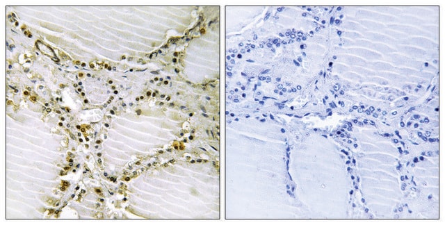 Anti-AMPD1 antibody produced in rabbit affinity isolated antibody