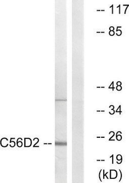 Anti-C56D2 antibody produced in rabbit affinity isolated antibody