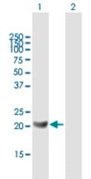 Anti-GM2A antibody produced in mouse purified immunoglobulin, buffered aqueous solution