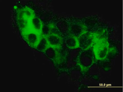 Monoclonal Anti-STEAP1 antibody produced in mouse clone 4F6-1F3, purified immunoglobulin, buffered aqueous solution