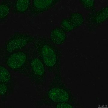 Anti-SUMO-2/3 Antibody, clone 8A2 clone 8A2, from mouse