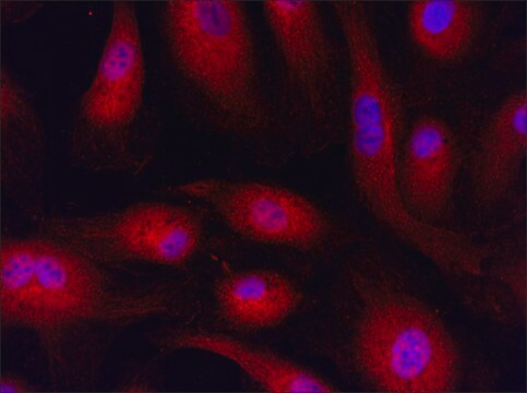 Anti-RNF4 (176-190) antibody produced in rabbit IgG fraction of antiserum, buffered aqueous solution