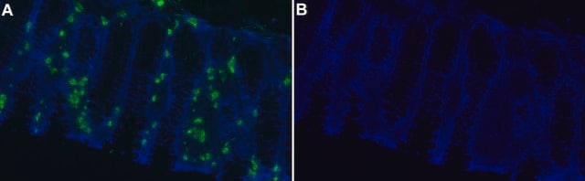 Anti-Eosinophil Peroxidase Antibody, clone AHE-1