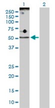 Anti-ADPGK antibody produced in rabbit purified immunoglobulin, buffered aqueous solution