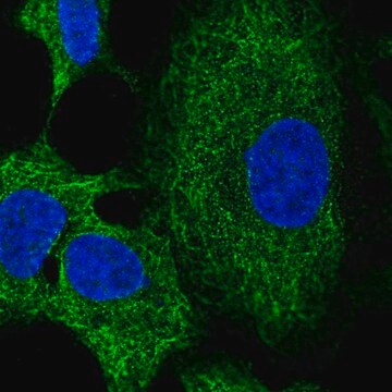 Anti-RNF215 antibody produced in rabbit Prestige Antibodies&#174; Powered by Atlas Antibodies, affinity isolated antibody