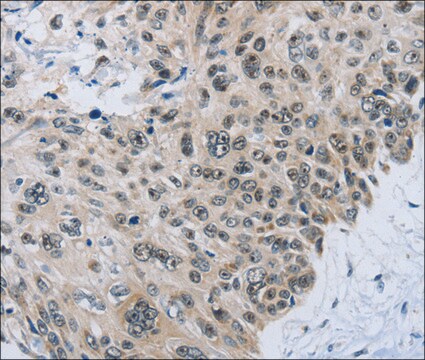 Anti-SLC16A4 antibody produced in rabbit affinity isolated antibody