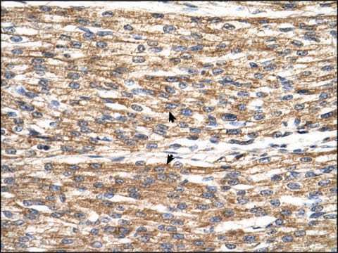 Anti-PNPLA3 antibody produced in rabbit affinity isolated antibody