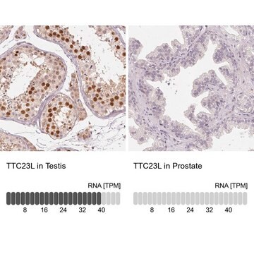 Anti-TTC23L antibody produced in rabbit Prestige Antibodies&#174; Powered by Atlas Antibodies, affinity isolated antibody, buffered aqueous glycerol solution