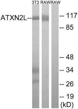 Anti-ATXN2L antibody produced in rabbit affinity isolated antibody