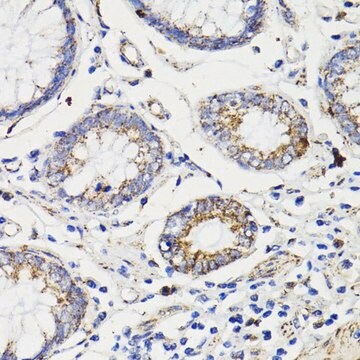 Anti-Caspase 8 antibody produced in rabbit