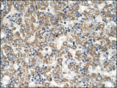 Anti-GOT2 (AB2) antibody produced in rabbit IgG fraction of antiserum