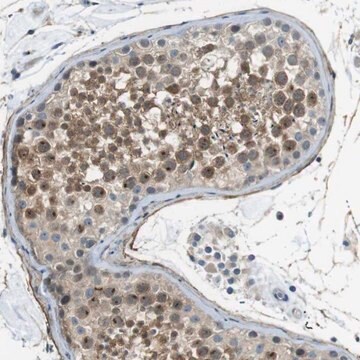 Anti-ENTPD7 antibody produced in rabbit Prestige Antibodies&#174; Powered by Atlas Antibodies, affinity isolated antibody, buffered aqueous glycerol solution