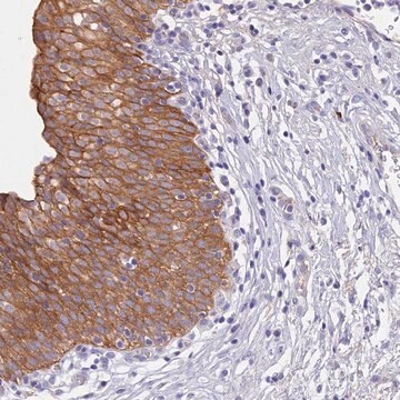 Anti-GK5 antibody produced in rabbit Prestige Antibodies&#174; Powered by Atlas Antibodies, affinity isolated antibody, buffered aqueous glycerol solution