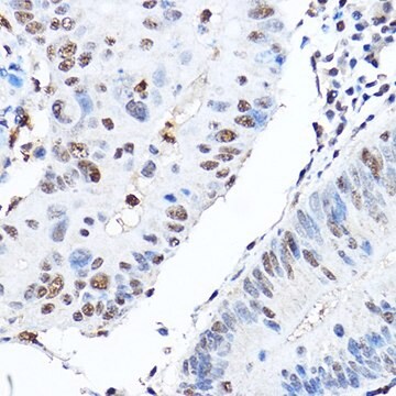 Anti- CTCF antibody produced in rabbit