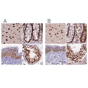 Anti-FAM103A1 antibody produced in rabbit Prestige Antibodies&#174; Powered by Atlas Antibodies, affinity isolated antibody, buffered aqueous glycerol solution