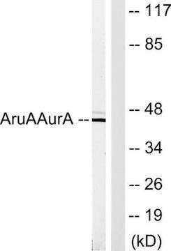 Anti-AURA antibody produced in rabbit affinity isolated antibody