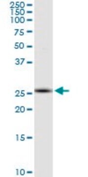 Monoclonal Anti-RNF170 antibody produced in mouse clone 2D6, purified immunoglobulin, buffered aqueous solution