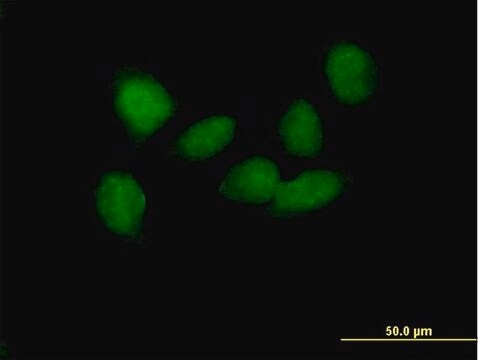 Anti-SOX6 antibody produced in mouse purified immunoglobulin, buffered aqueous solution