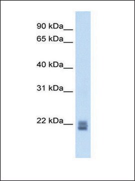 Anti-RGS1 antibody produced in rabbit IgG fraction of antiserum