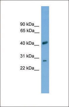 Anti-SLC25A37 antibody produced in rabbit affinity isolated antibody