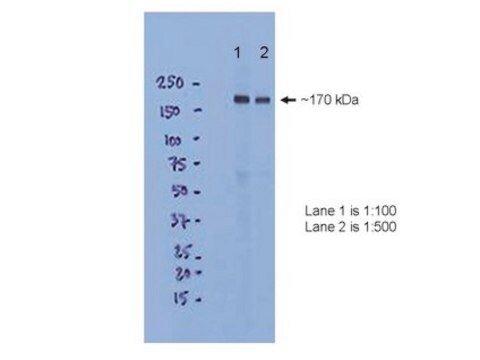 Anticorps anti-NMDAR2B, CT ascites fluid, clone 1C6.5C4, Chemicon&#174;